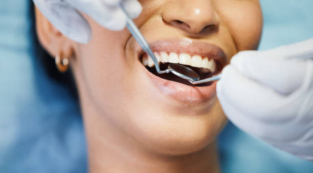 Best Chipped Tooth Repair Near Me  in Van Meter, IA