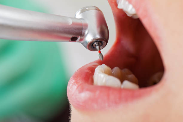 Best Dentist for Tooth Abscess  in Van Meter, IA